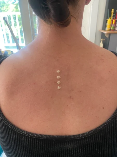 Kambo medicine dots 1